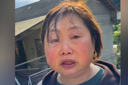 每天该吃多少膳食纤维？专家给出标准量
